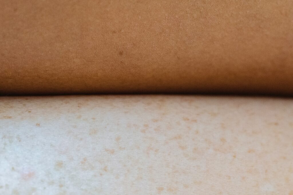 Two skin tones for how to repair the skin barrier.